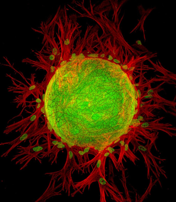 Конфокальное и флуоресцентное изображение лимфатических эндотелиальных клеток и фибробластов. 200-кратное увеличение